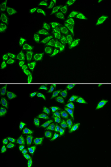 DLAT Rabbit polyclonal antibody