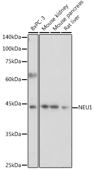 NEU1 Rabbit polyclonal antibody