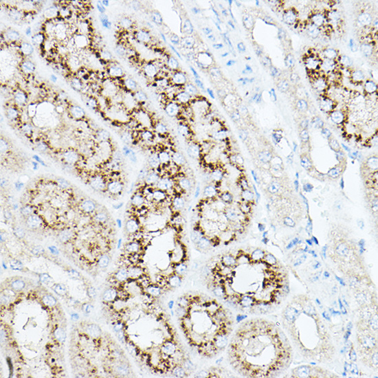NEU1 Rabbit polyclonal antibody