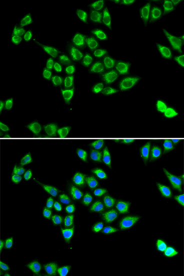 Pyruvate carboxylase (PC) Rabbit polyclonal antibody