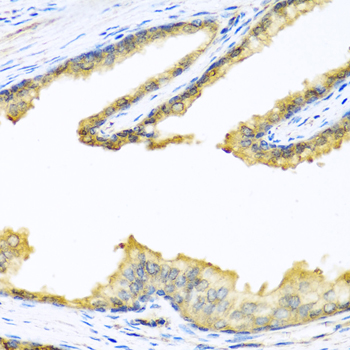 PENK Rabbit polyclonal antibody