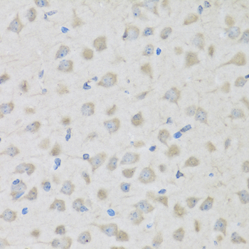 PENK Rabbit polyclonal antibody