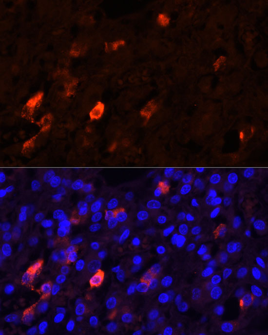 PENK Rabbit polyclonal antibody