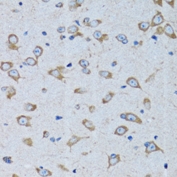 RARS Rabbit polyclonal antibody