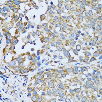 RARS Rabbit polyclonal antibody