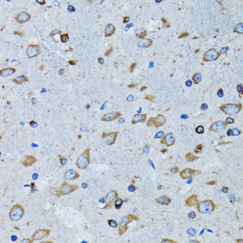 RARS Rabbit polyclonal antibody