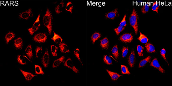 RARS Rabbit polyclonal antibody