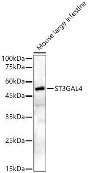 ST3GAL4 Rabbit polyclonal antibody