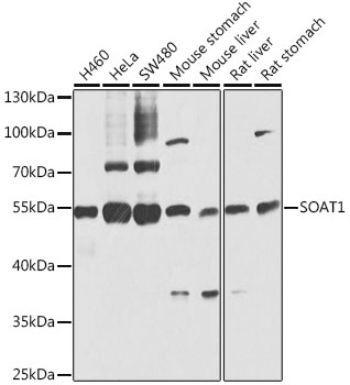 SOAT1 Rabbit polyclonal antibody