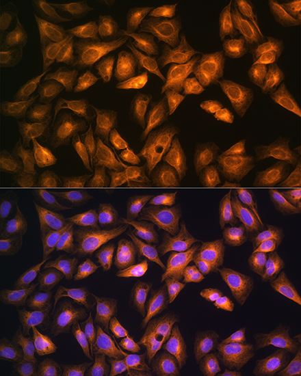 SOAT1 Rabbit polyclonal antibody