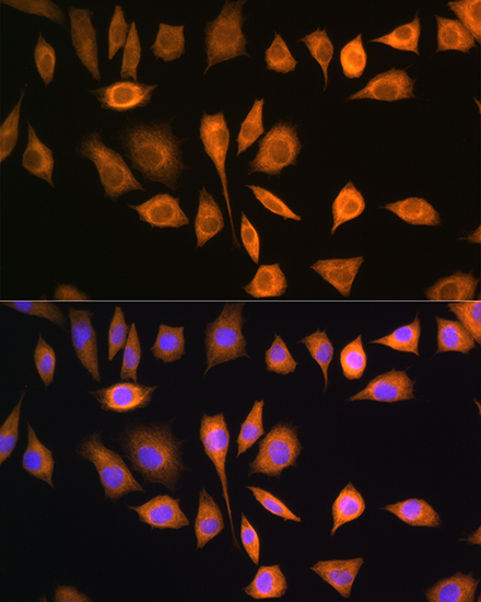 SOAT1 Rabbit polyclonal antibody