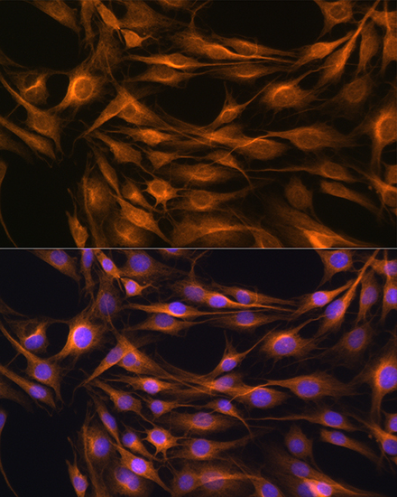 SOAT1 Rabbit polyclonal antibody