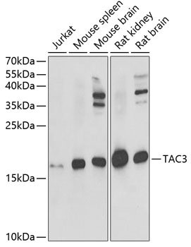 TAC3 Rabbit polyclonal antibody