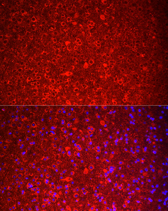 TAC3 Rabbit polyclonal antibody