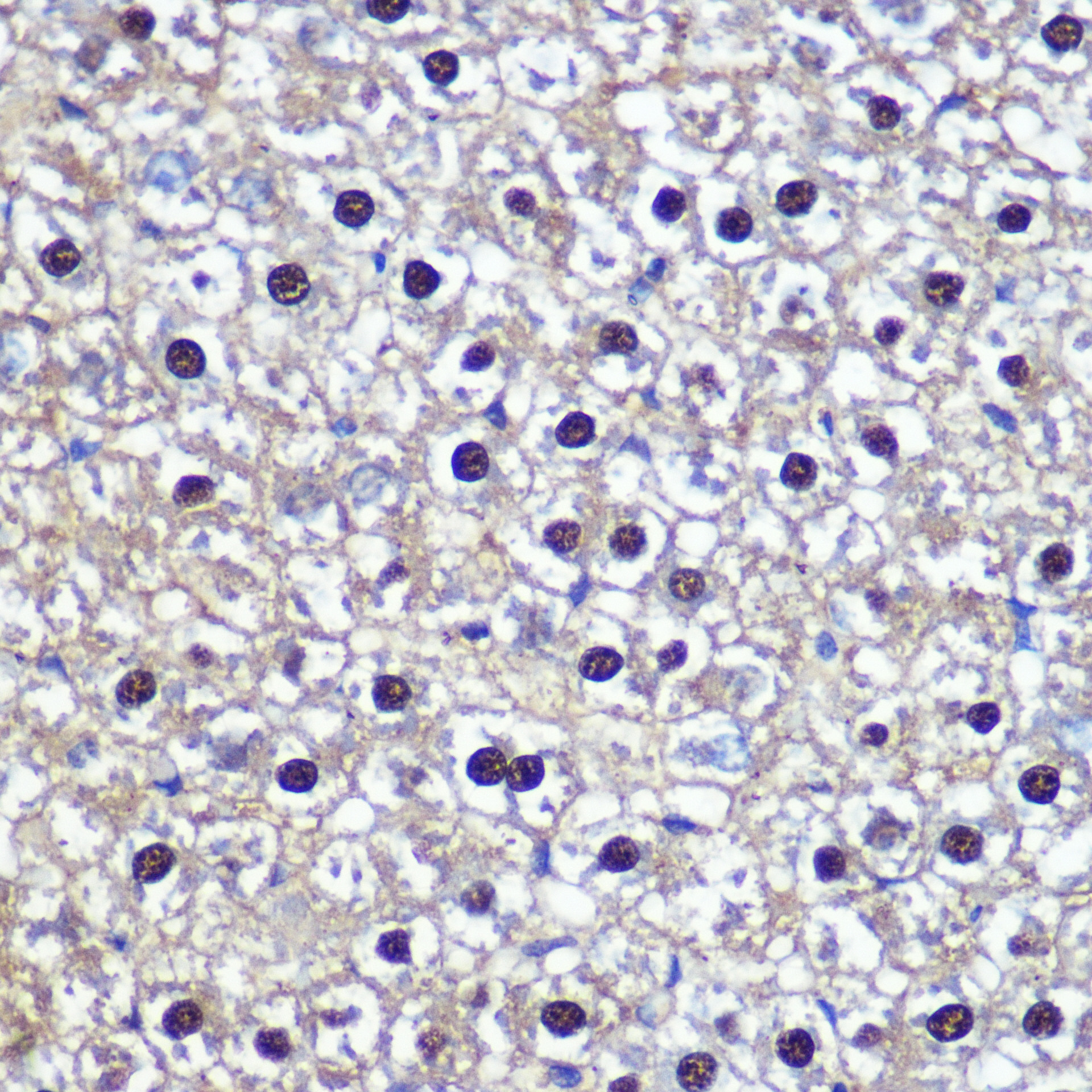 TKT Rabbit polyclonal antibody