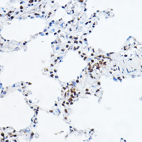 YEATS4 Rabbit polyclonal antibody
