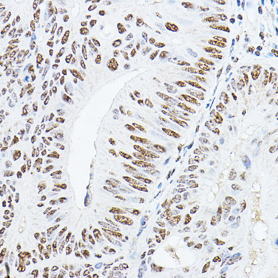 YEATS4 Rabbit polyclonal antibody