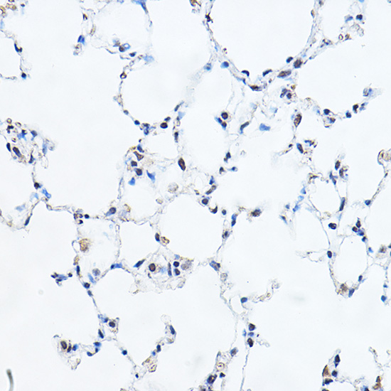 YEATS4 Rabbit polyclonal antibody