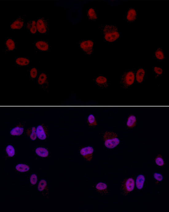 YEATS4 Rabbit polyclonal antibody