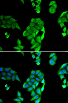 NOL3 Rabbit polyclonal antibody