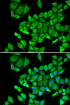 DHRS9 Rabbit polyclonal antibody