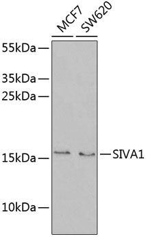SIVA1 Rabbit polyclonal antibody