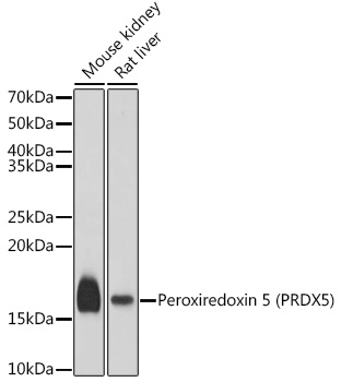 Peroxiredoxin 5 (PRDX5) Rabbit polyclonal antibody