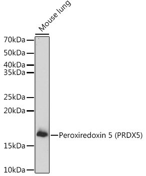 Peroxiredoxin 5 (PRDX5) Rabbit polyclonal antibody
