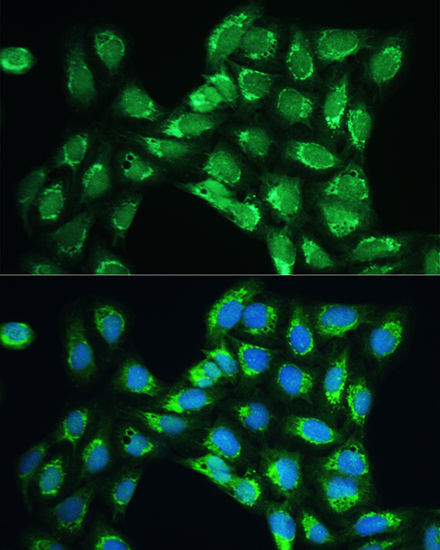 Peroxiredoxin 5 (PRDX5) Rabbit polyclonal antibody