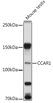 CCAR1 Rabbit polyclonal antibody