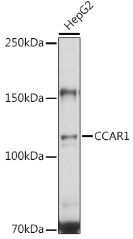 CCAR1 Rabbit polyclonal antibody