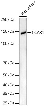 CCAR1 Rabbit polyclonal antibody