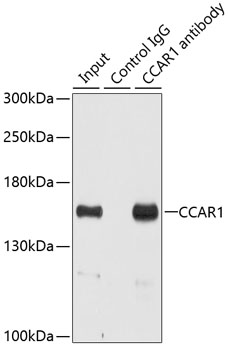 CCAR1 Rabbit polyclonal antibody