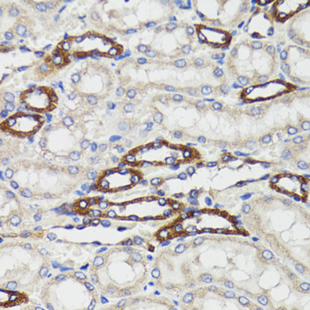 BCAP29 Rabbit polyclonal antibody