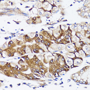 BCAP29 Rabbit polyclonal antibody