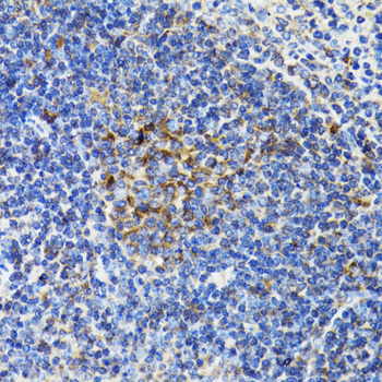 BCAP29 Rabbit polyclonal antibody