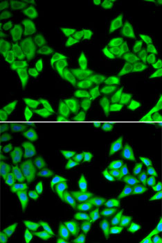 CIAPIN1 Rabbit polyclonal antibody