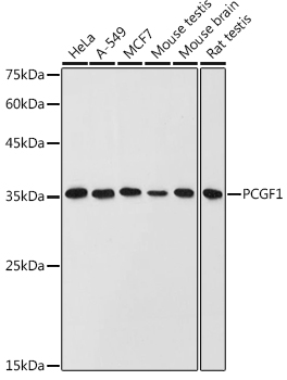 PCGF1 Rabbit polyclonal antibody
