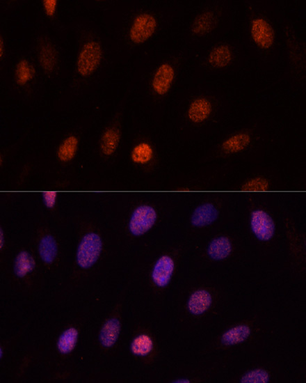 PCGF1 Rabbit polyclonal antibody
