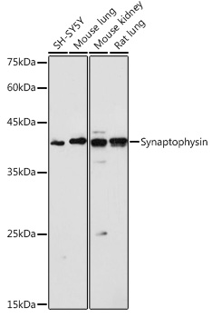 Synaptophysin Rabbit polyclonal antibody