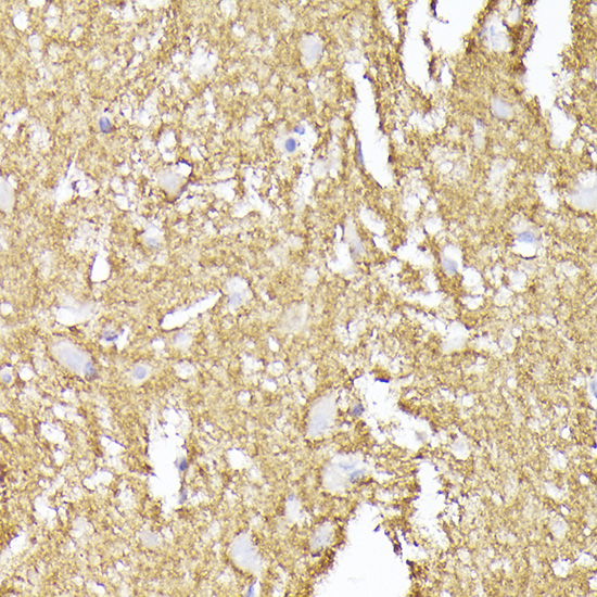 Synaptophysin Rabbit polyclonal antibody