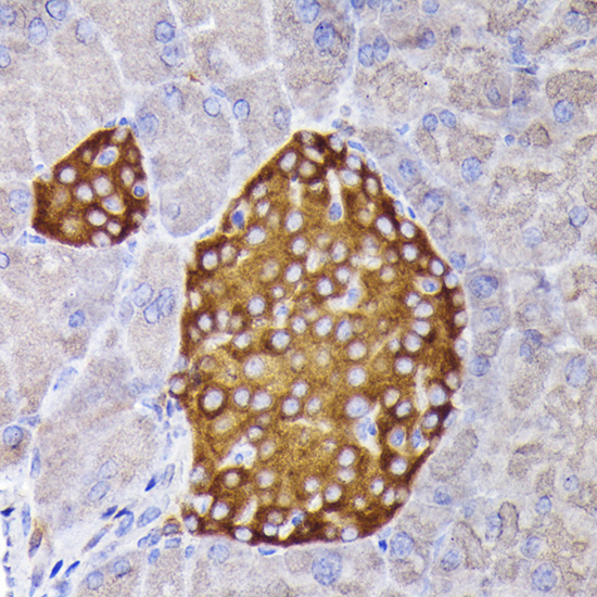 Synaptophysin Rabbit polyclonal antibody