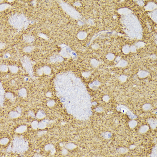 Synaptophysin Rabbit polyclonal antibody