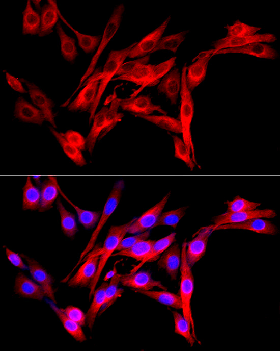 Fibroblast activation protein-A Alpha (FAP) Rabbit polyclonal antibody