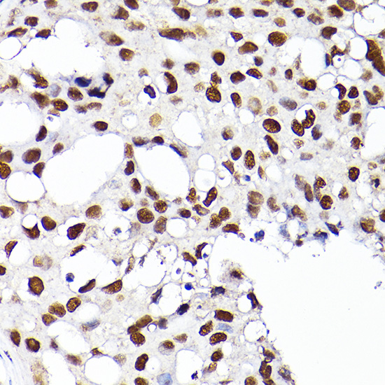 RCC1 Rabbit polyclonal antibody
