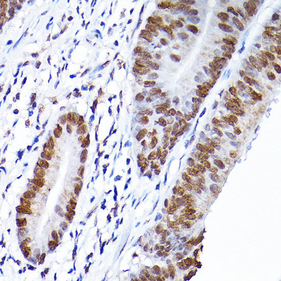 RCC1 Rabbit polyclonal antibody