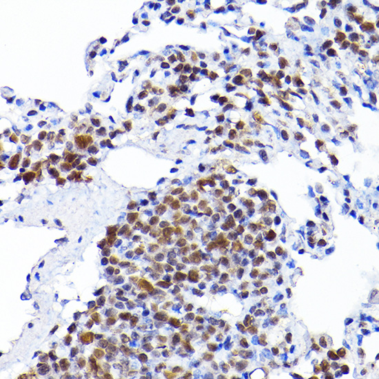 RCC1 Rabbit polyclonal antibody