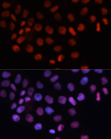 RCC1 Rabbit polyclonal antibody