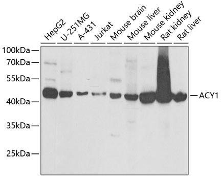 ACY1 Rabbit polyclonal antibody
