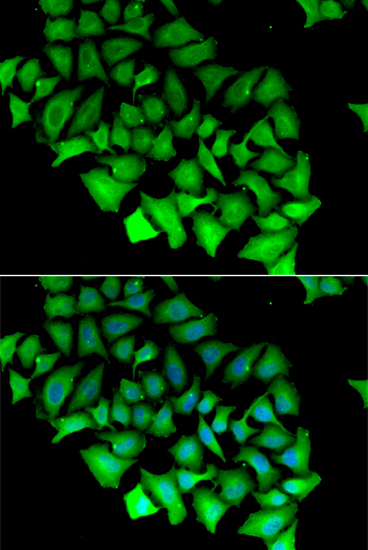 ACY1 Rabbit polyclonal antibody
